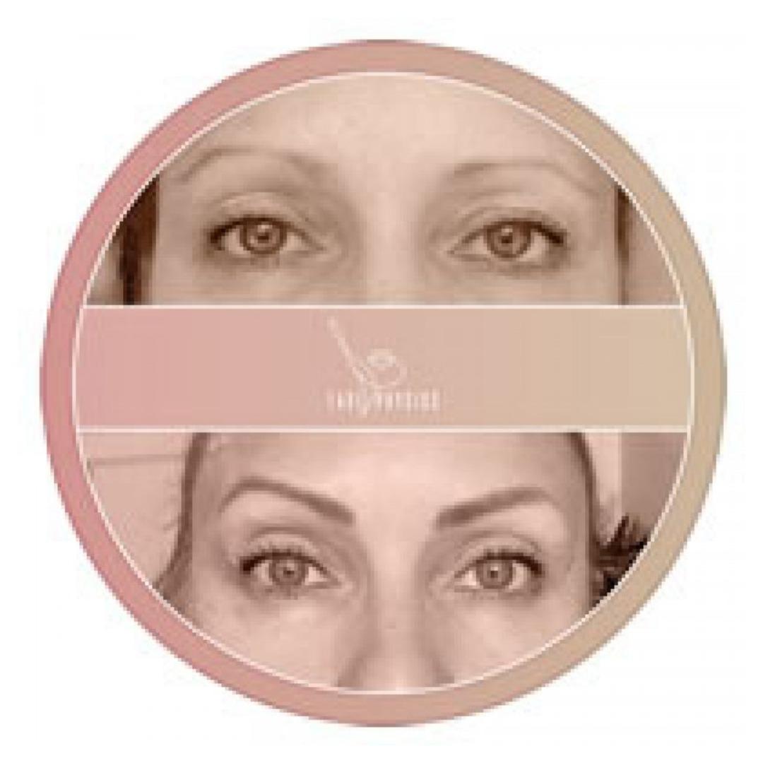 FacePhysics Intensiivikurssi: Silmäluomien kohotus – kuva 1